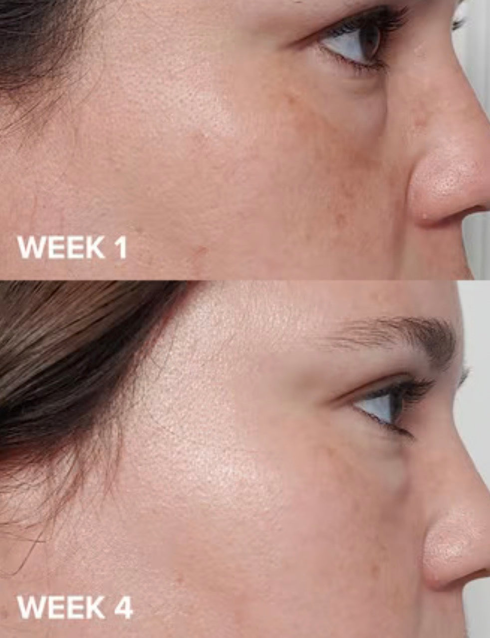 Paulas Choice Skin Perfecting 2% BHA Liquid Salicylic Acid Exfoliant